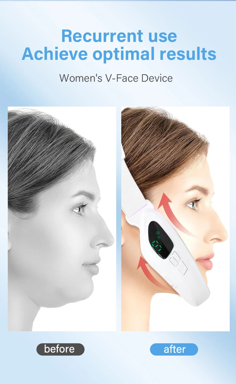 4-in-1 Electric Double Chin Remover | V-Line Face Slimming & Lifting Massager with Remote Control