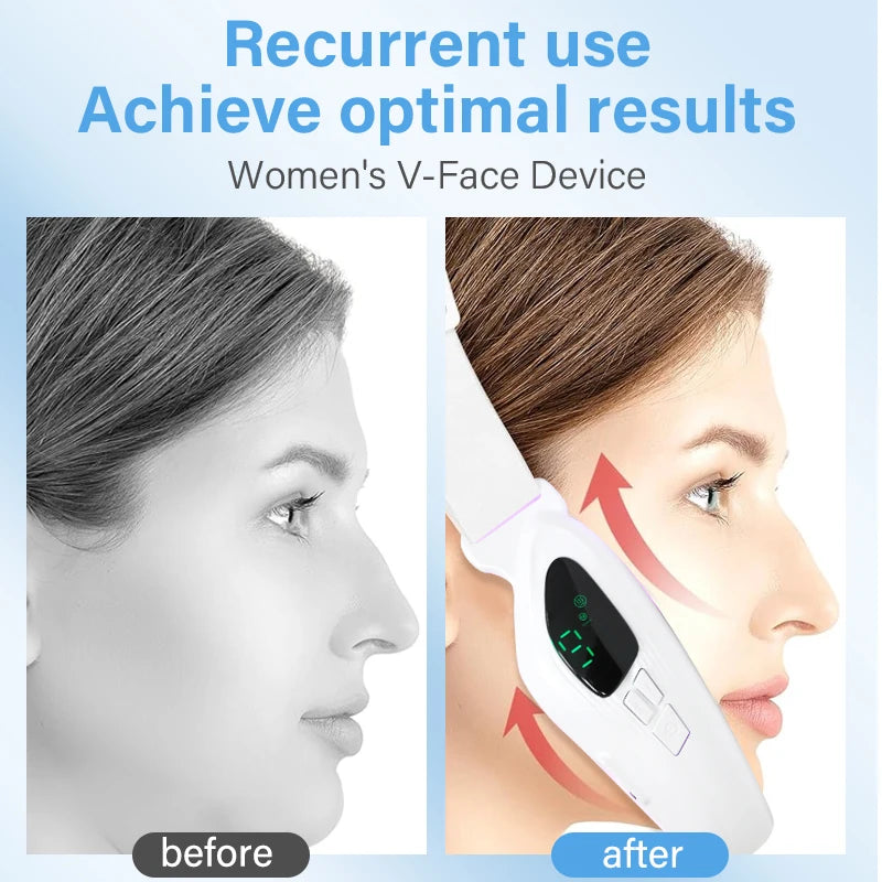 4-in-1 Electric Double Chin Remover | V-Line Face Slimming & Lifting Massager with Remote Control
